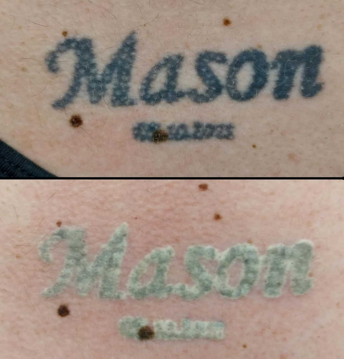 Close-up of Two Faded Tattoos — Laserpro Tattoo Removal in Illawarra, NSW
