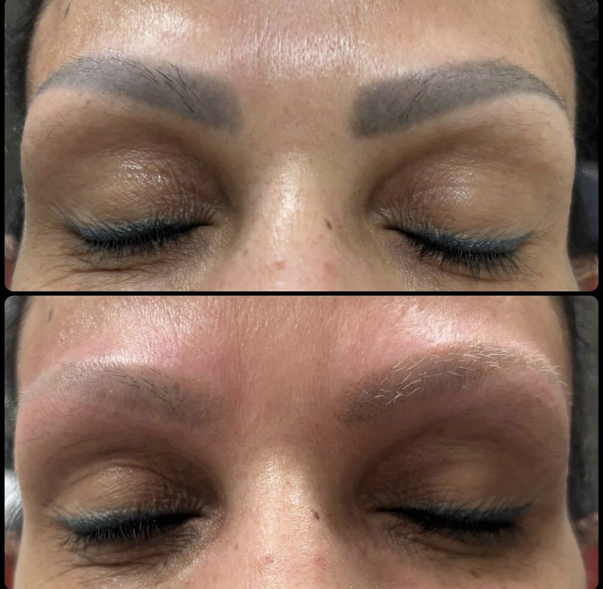 Closed eyes with dark arched eyebrows shown before and after a cosmetic treatment comparison — Laserpro Tattoo Removal in Shellharbour, NSW