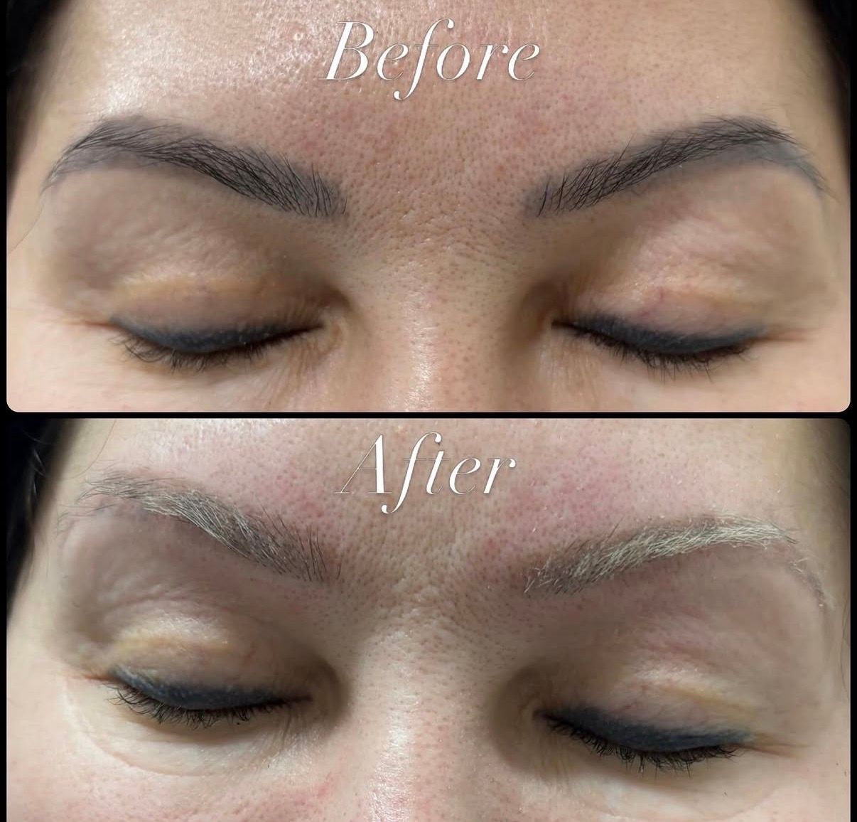 Before-and-after close-up of closed eyelids and eyebrows, showing eyebrow tinting or shaping results. — Laserpro Tattoo Removal in Shellharbour, NSW