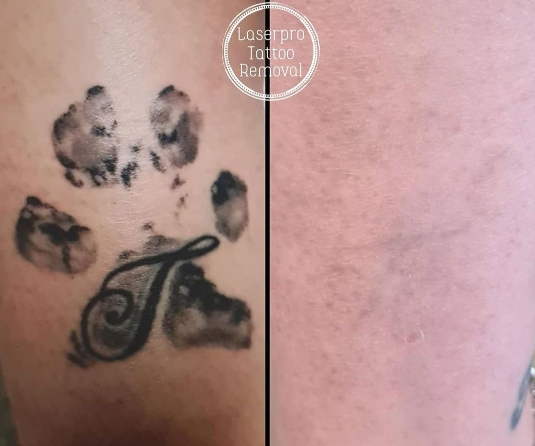 Black Paw-print Tattoo With a Cursive — Laserpro Tattoo Removal in Shellharbour, NSW
