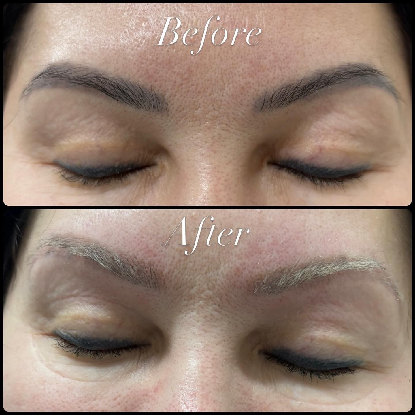 Before-and-after close-up of eyebrows and closed eyes, showing fuller, lighter brows in the after image. — Laserpro Tattoo Removal in Shellharbour, NSW