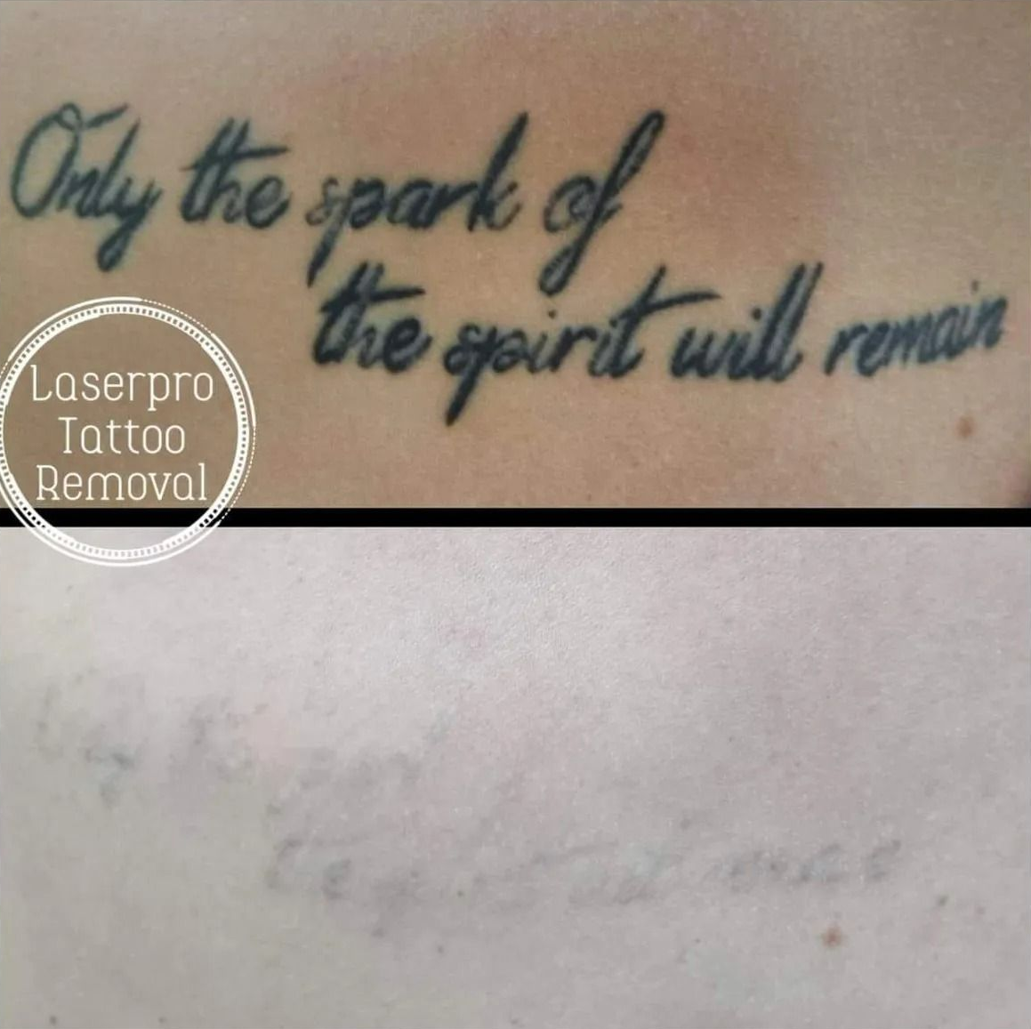 Small Blue Script Tattoo — Laserpro Tattoo Removal in Shellharbour, NSW