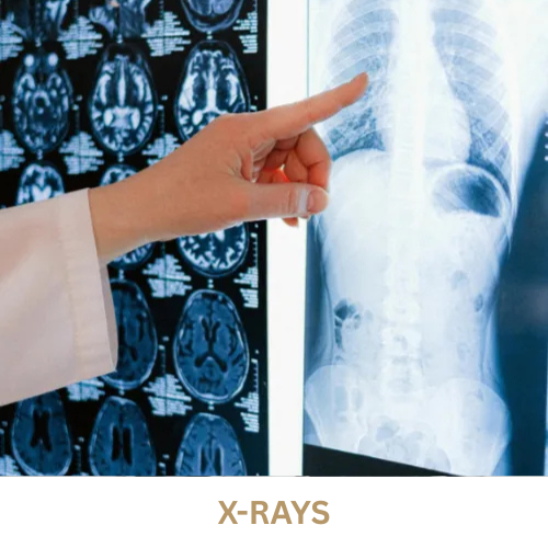 Diagnostic Testing 4