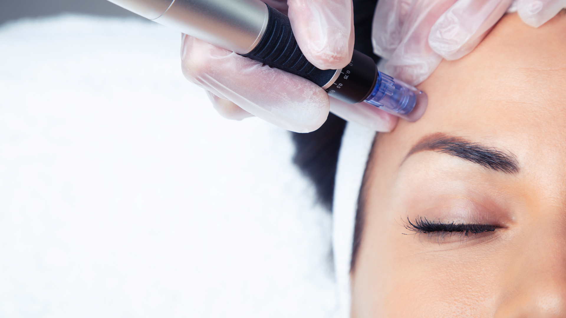 Close-up of a person's face receiving a microneedling treatment. A gloved hand holds the device near the eye.