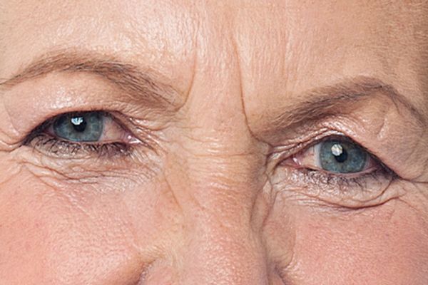 A close up of an elderly woman 's eyes with wrinkles.