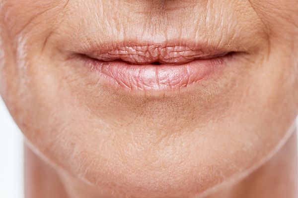 A close up of an older woman 's mouth with wrinkles.