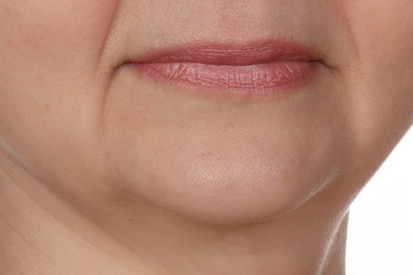 A close up of a woman 's mouth with wrinkles.