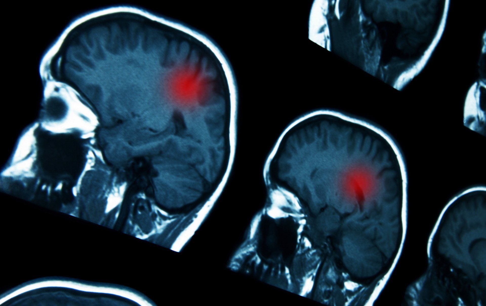 Neuro-oncologista que atende por telemedicina