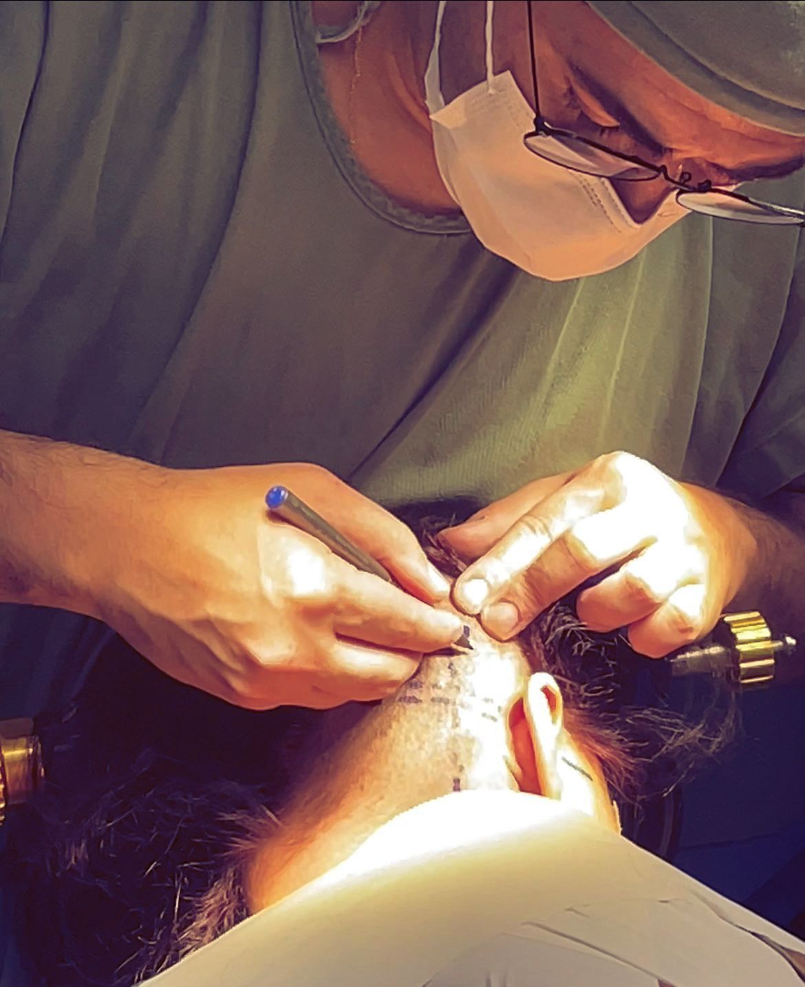 Cirurgia para Neuralgia do Trigemeo.