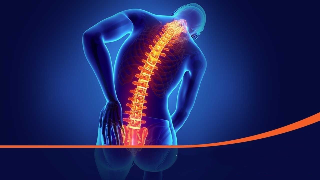 Eletrodo Medular para dores crônicas de coluna.
