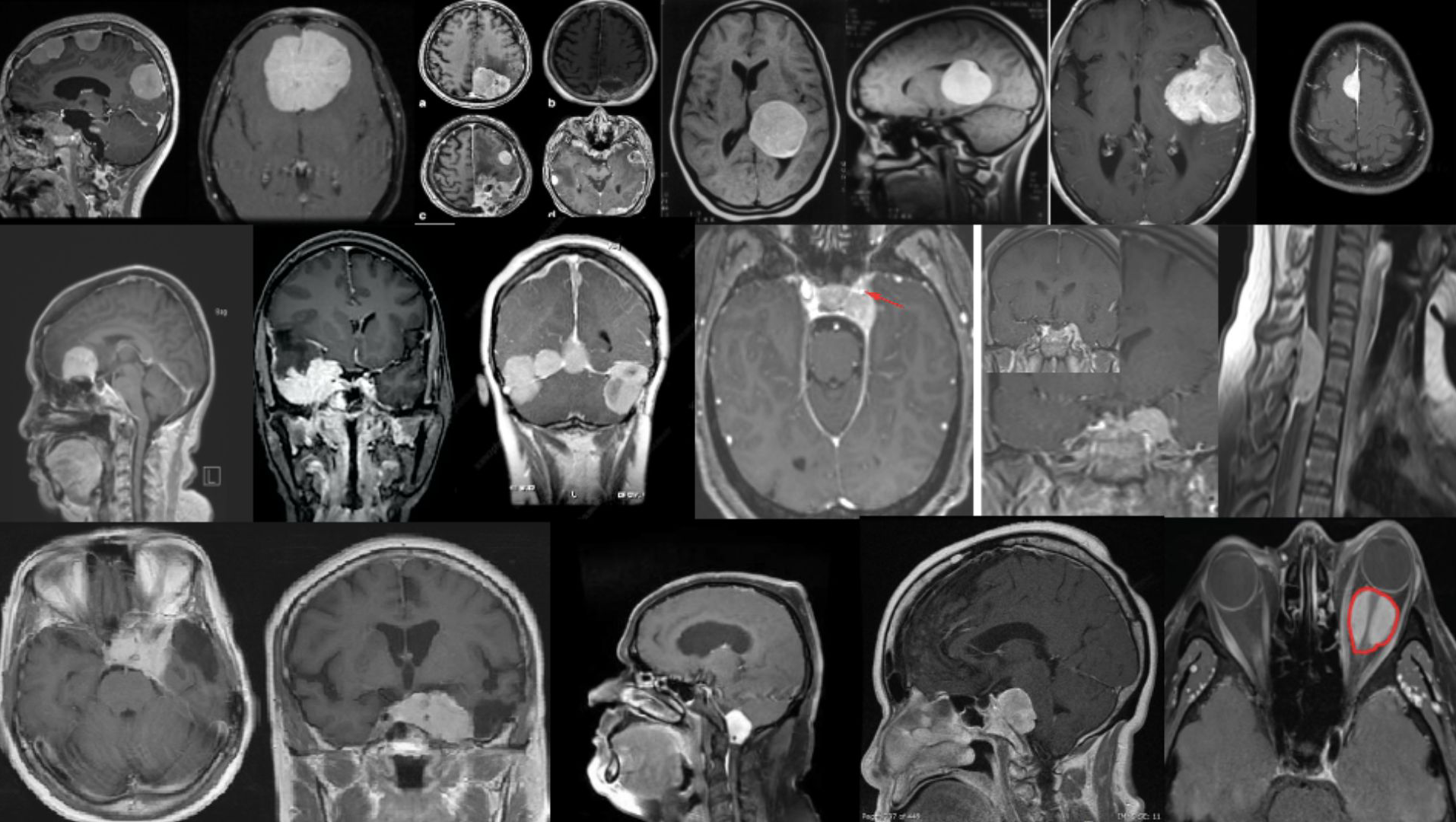 Neurocirurgião especialista em crânio em Curitiba