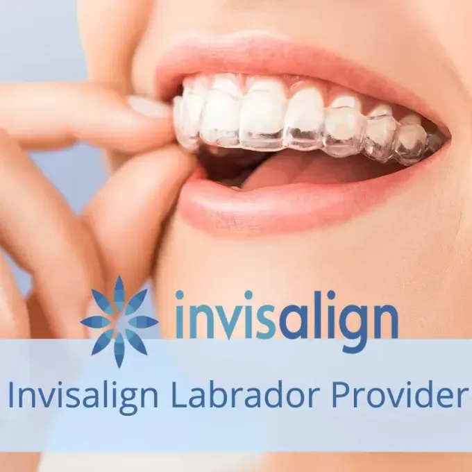 invisalign labrador supporto, supporto dottori invisalign