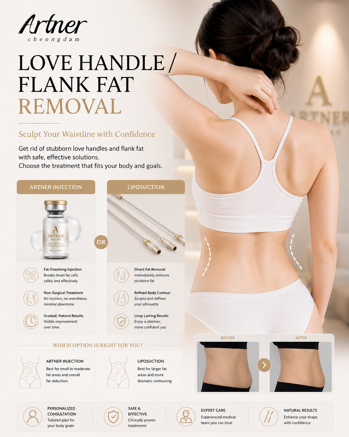 Flank love-handle contouring at ARTNER Cheongdam