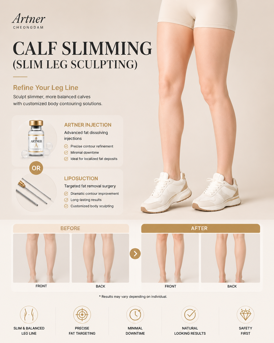 Calf contouring at ARTNER Cheongdam