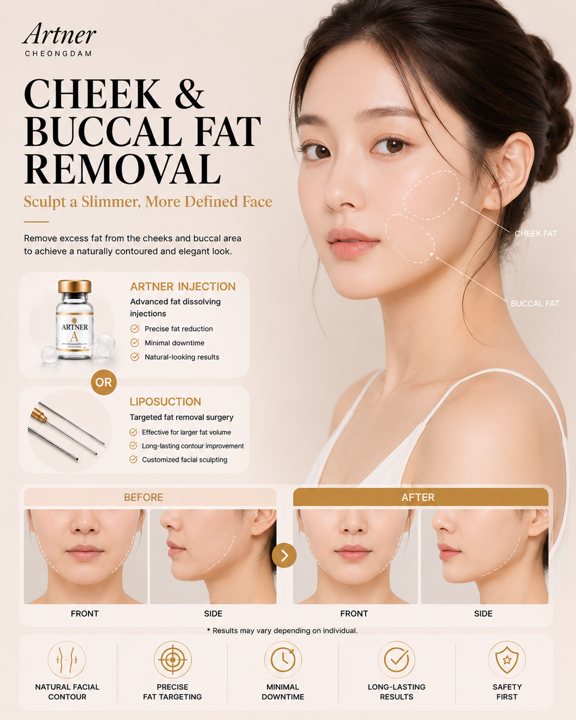 Face and cheek slimming at ARTNER Cheongdam