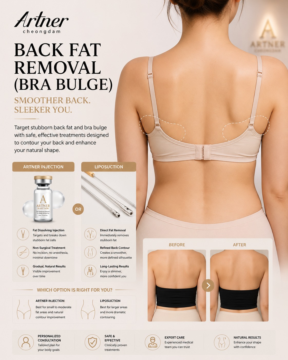 Back contouring at ARTNER Cheongdam