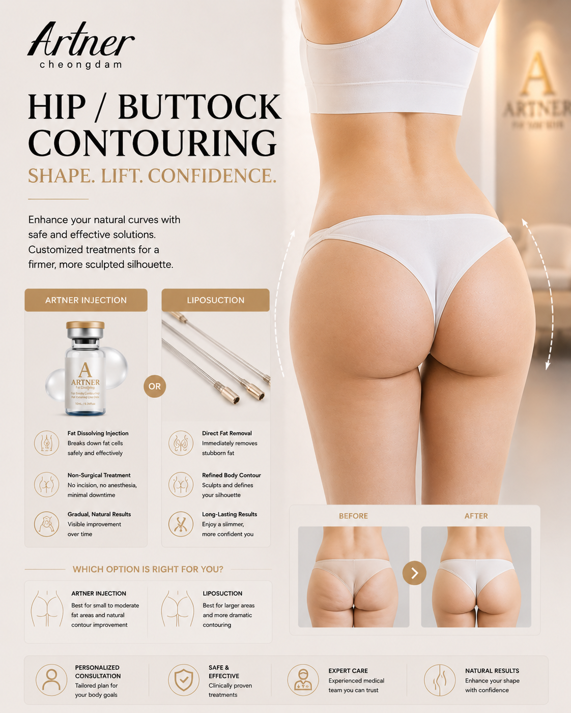 Hip dip fat grafting at ARTNER Cheongdam