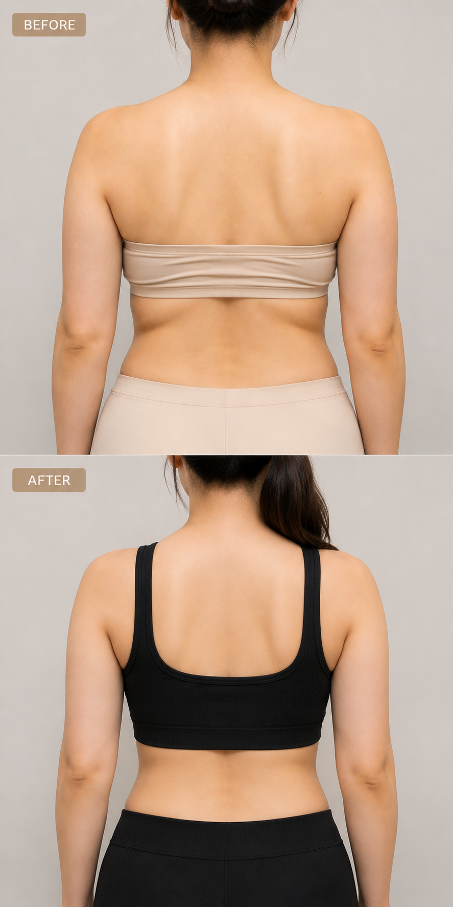 Back fat bra bulge before and after