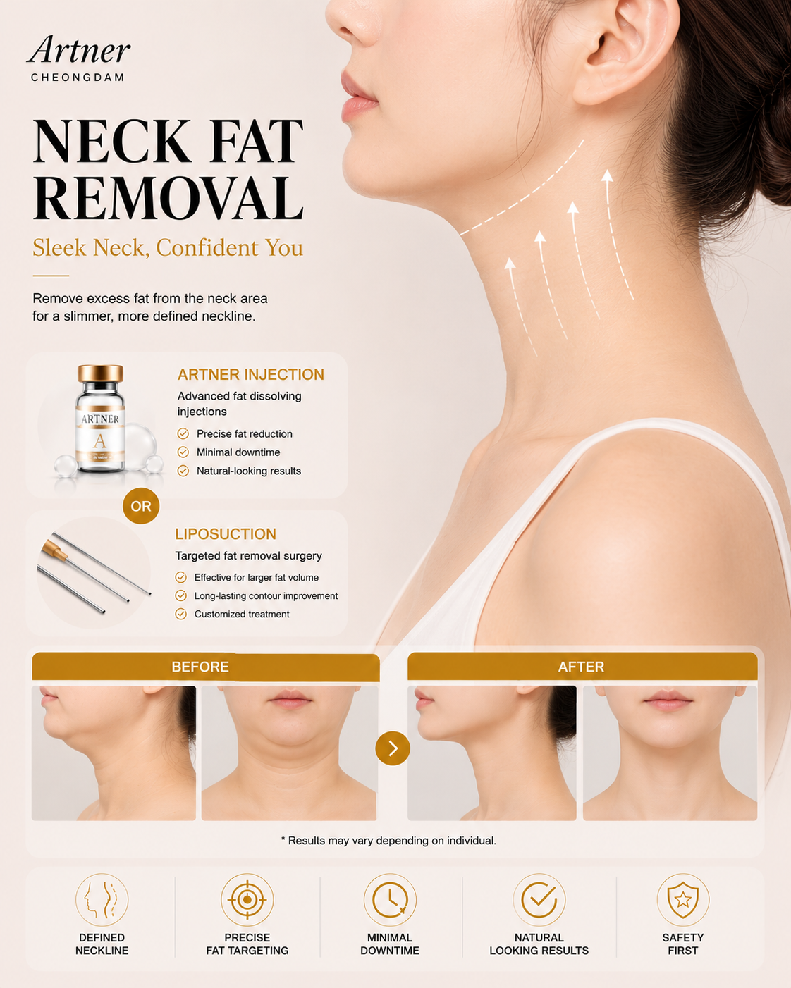 Neck contouring at ARTNER Cheongdam