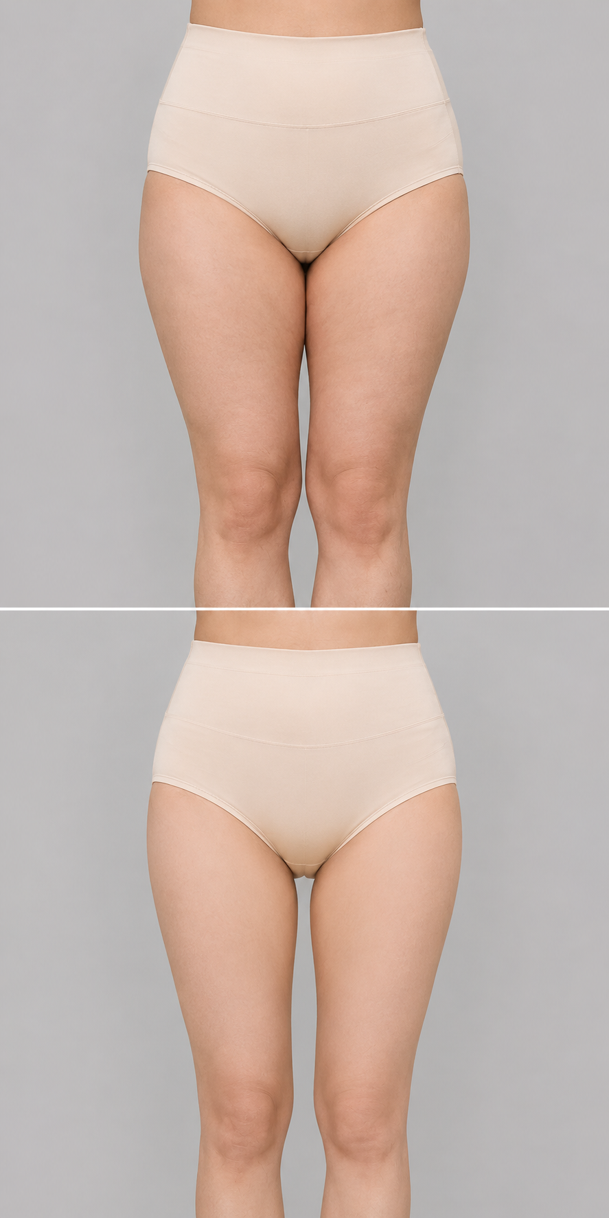 Abdomen and mons pubis liposuction before and after