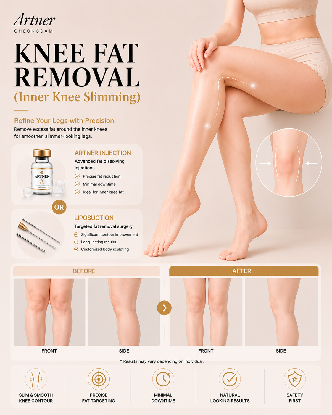 Inner knee contouring at ARTNER Cheongdam