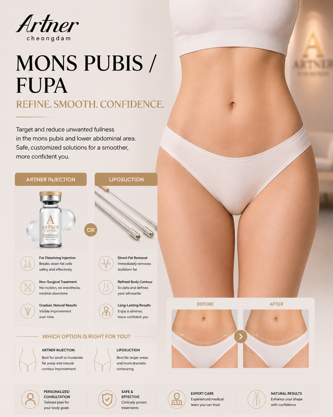 Mons pubis contouring at ARTNER Cheongdam