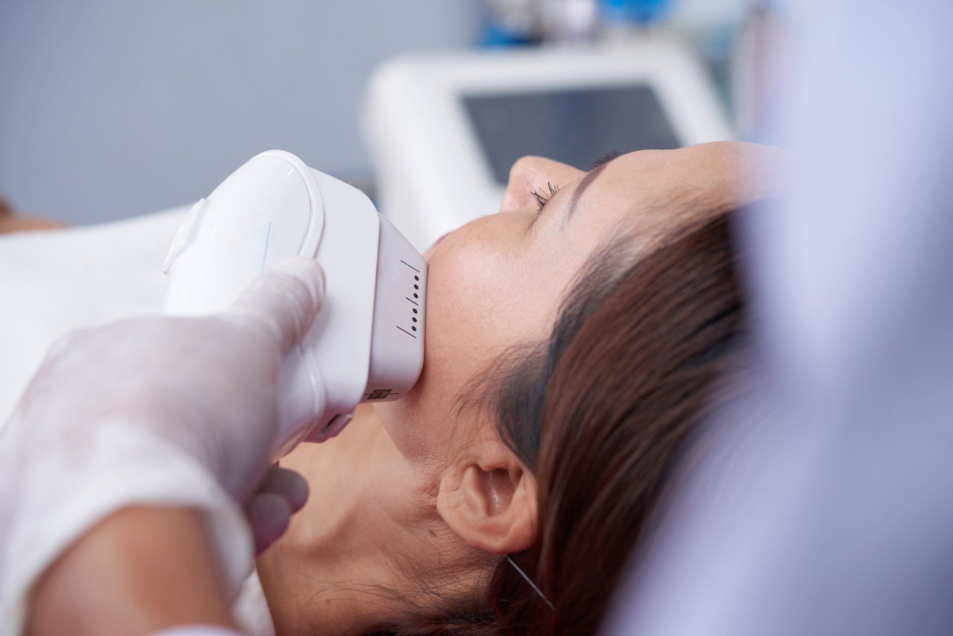 laser hair removal on womans face