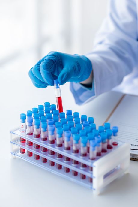 Gloved lab worker pipetting red liquid into a rack of blue-capped test tubes