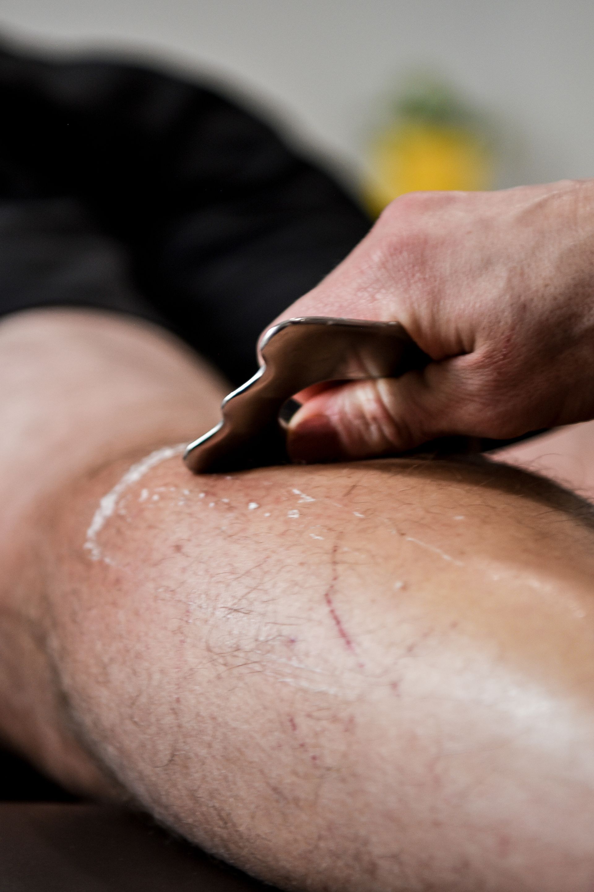 Person's leg being scraped with a metal tool, likely for a therapeutic treatment.