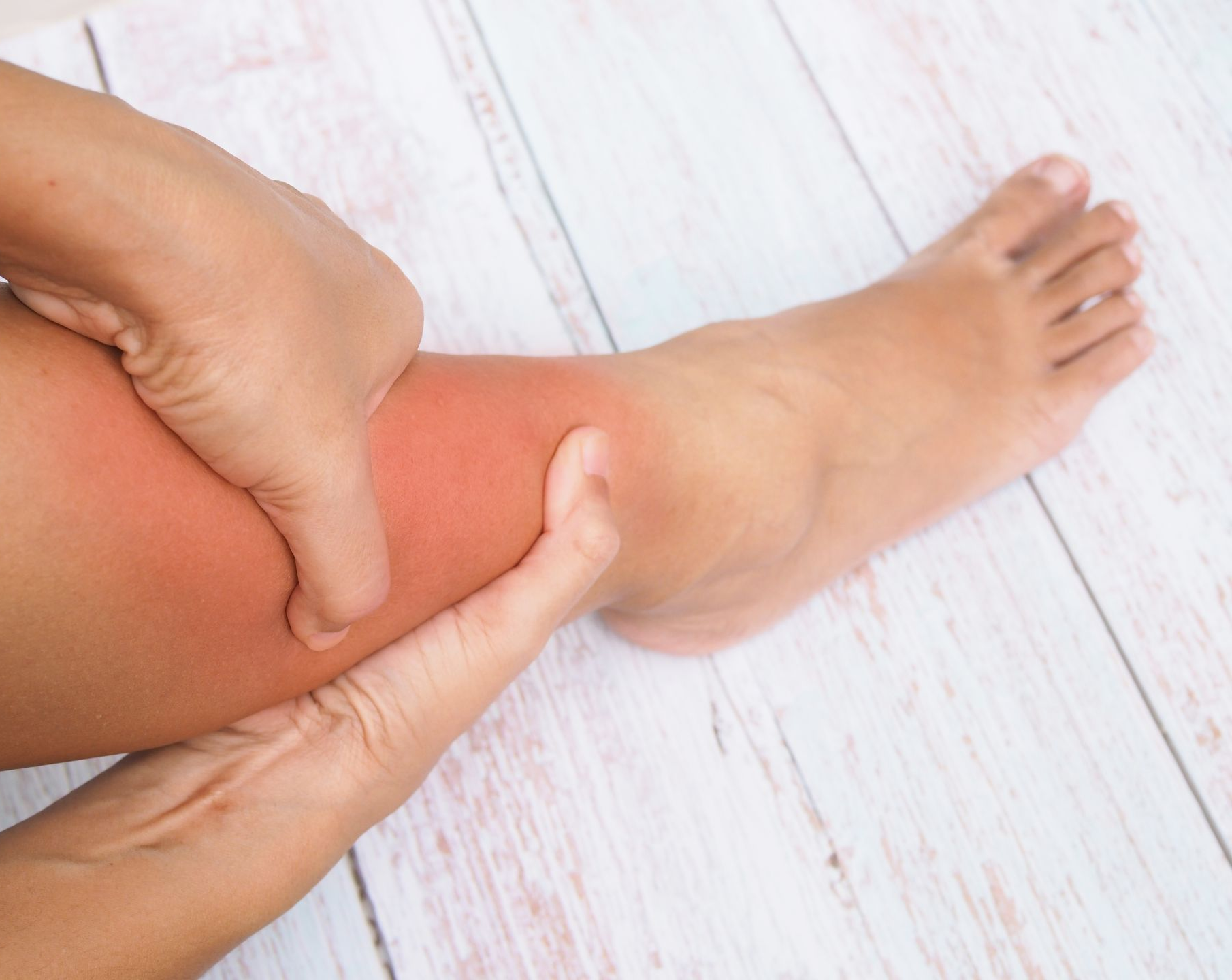 Hands massaging a red, irritated lower leg and ankle on a light wooden floor