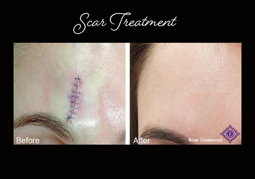 Z Aesthetic Dermatology in Baton Rouge & Prairieville