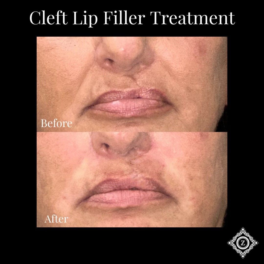 Z Aesthetic Dermatology in Baton Rouge & Prairieville