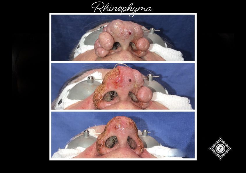 Z Aesthetic Dermatology in Baton Rouge & Prairieville