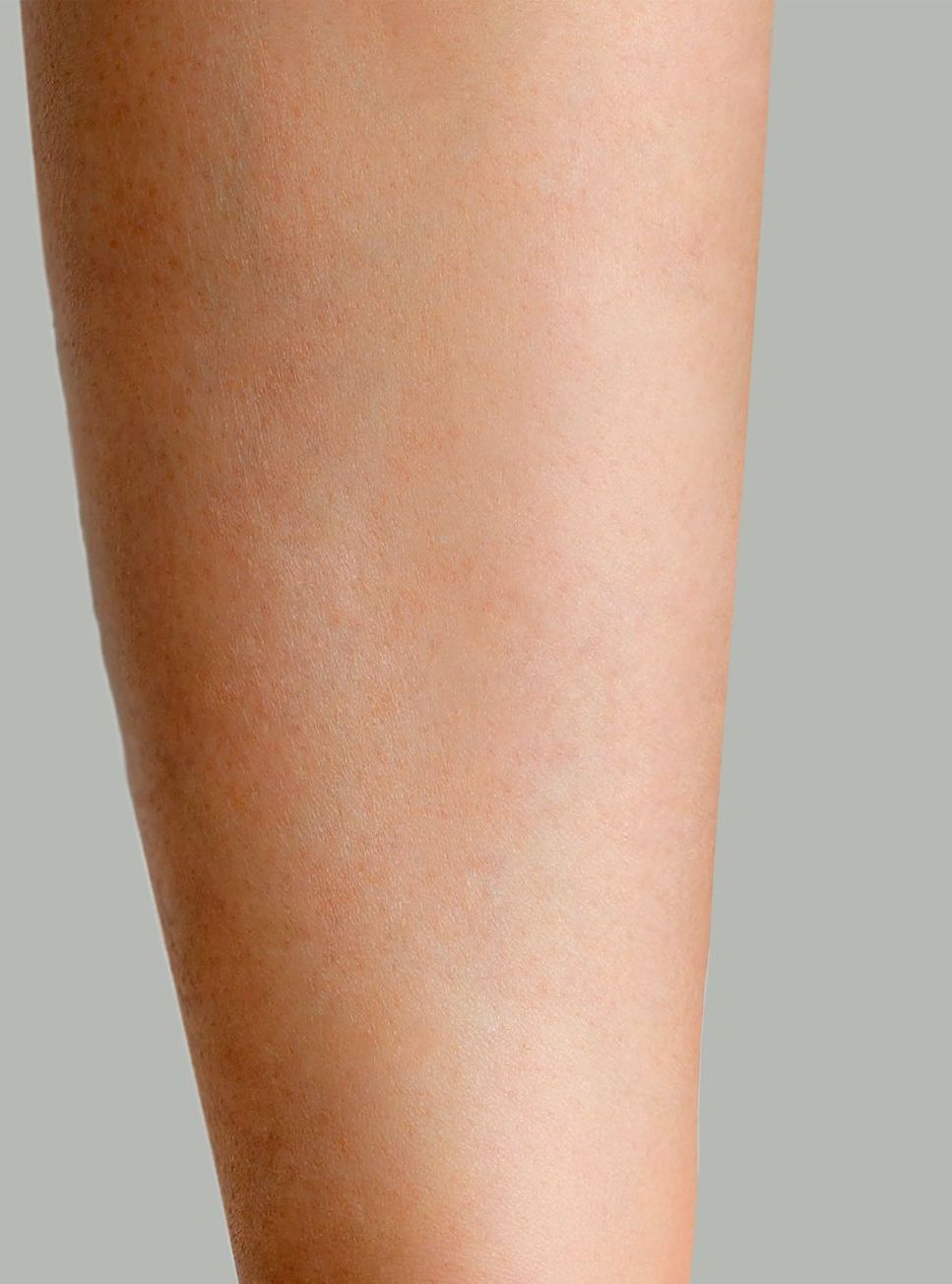 Z Aesthetic Dermatology in Baton Rouge & Prairieville