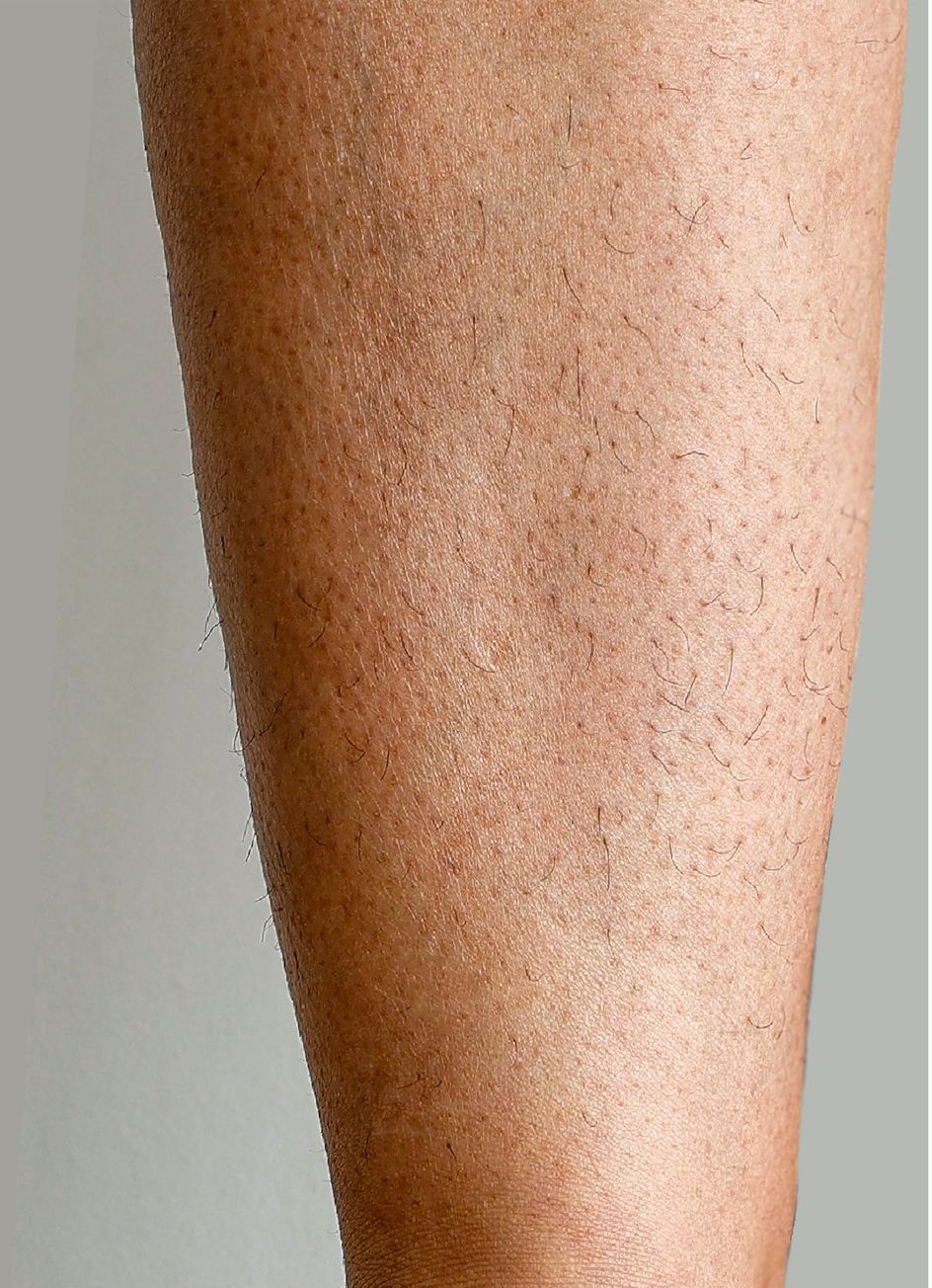 Z Aesthetic Dermatology in Baton Rouge & Prairieville