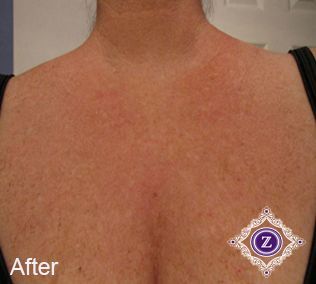 Z Aesthetic Dermatology in Baton Rouge & Prairieville