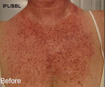 Z Aesthetic Dermatology in Baton Rouge & Prairieville