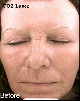 Z Aesthetic Dermatology in Baton Rouge & Prairieville