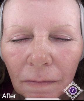 Z Aesthetic Dermatology in Baton Rouge & Prairieville