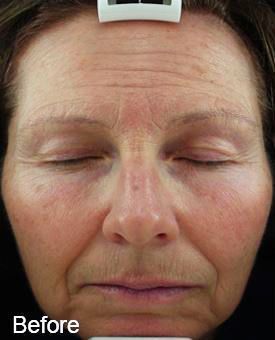 Z Aesthetic Dermatology in Baton Rouge & Prairieville