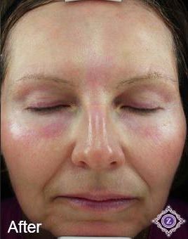 Z Aesthetic Dermatology in Baton Rouge & Prairieville