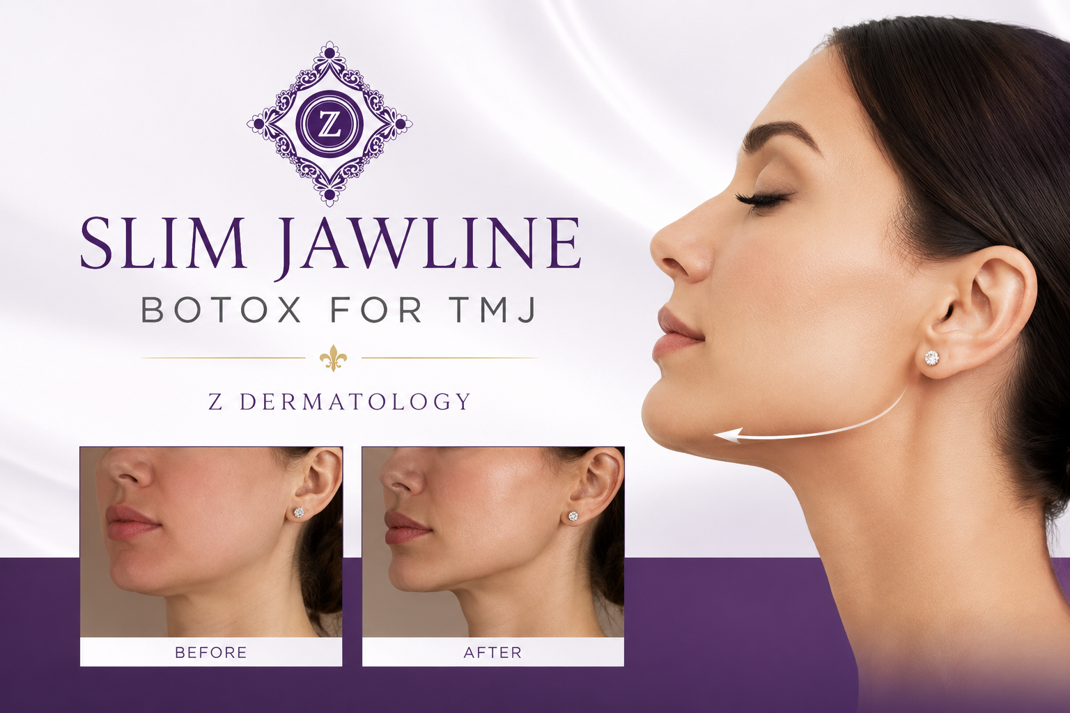 Slim Jawline Botox Baton Rouge | TMJ Botox & Masseter Botox at Z Dermatology
