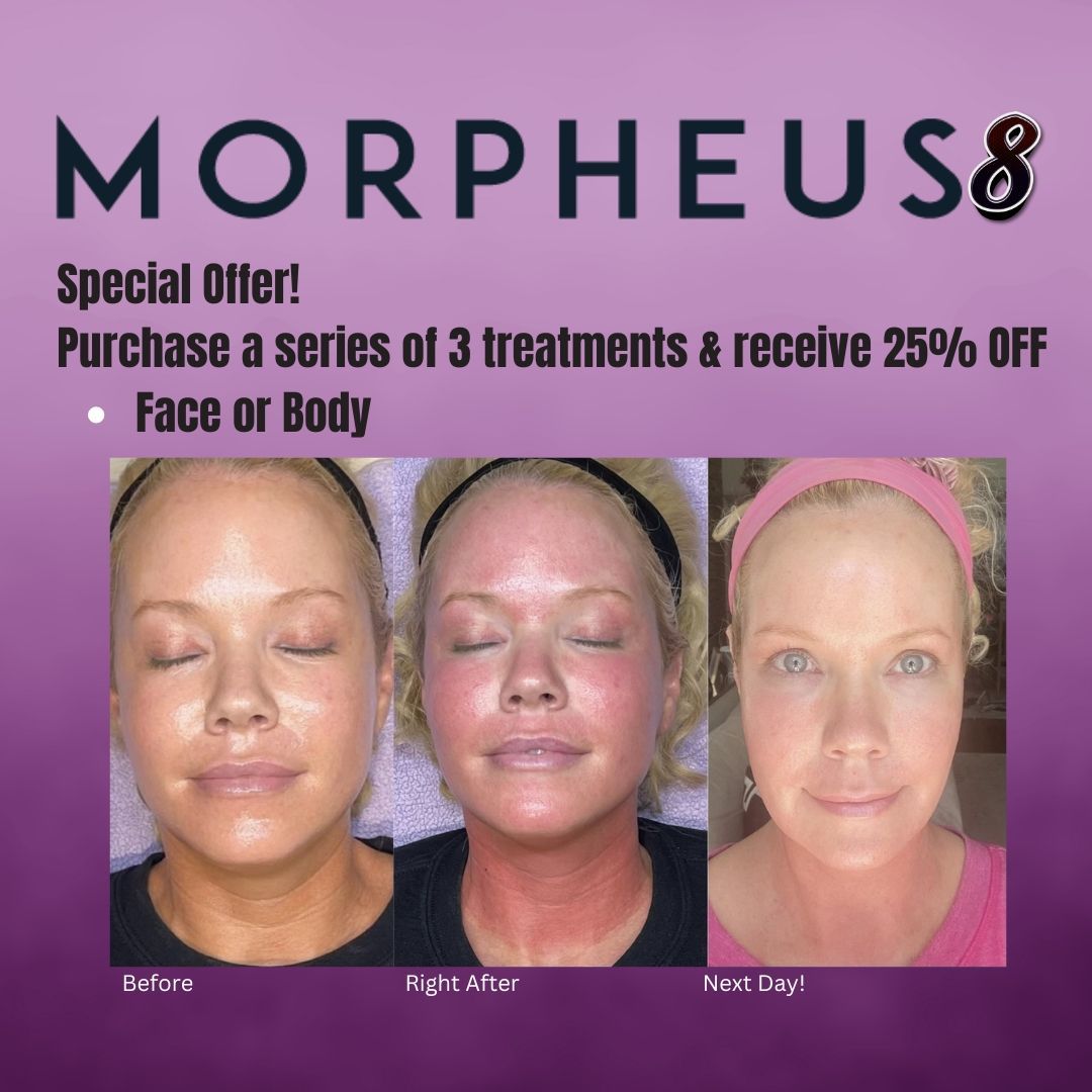 Baton Rouge Microneedling Before and After Z Dermatology