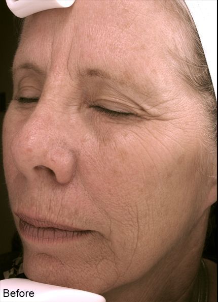 Z Aesthetic Dermatology in Baton Rouge & Prairieville