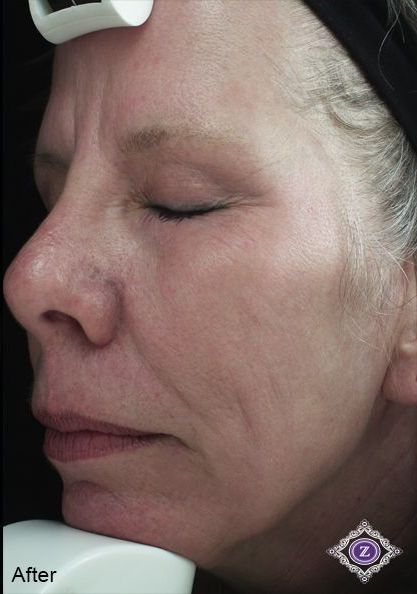 Z Aesthetic Dermatology in Baton Rouge & Prairieville