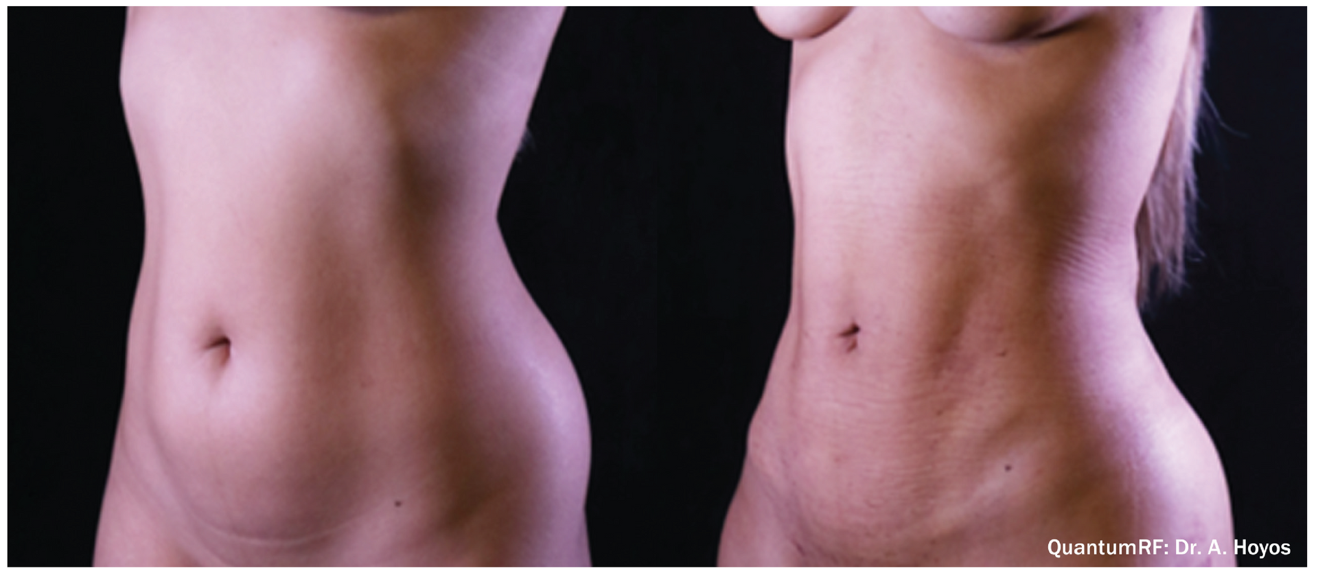 Z Aesthetic Dermatology in Baton Rouge & Prairieville
