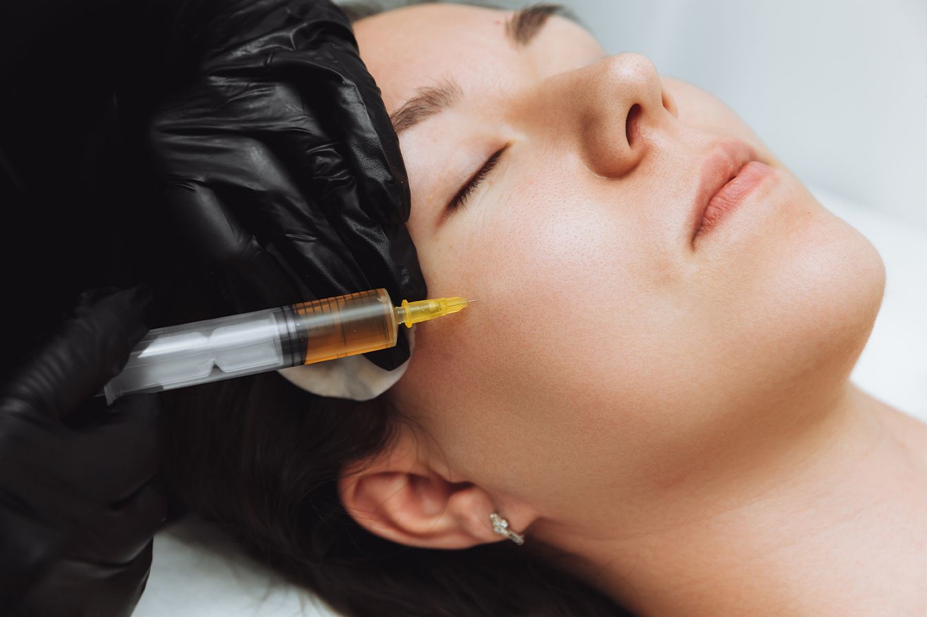 PRP Face Treatments in Baton Rouge and Prairieville at Z Dermatology.