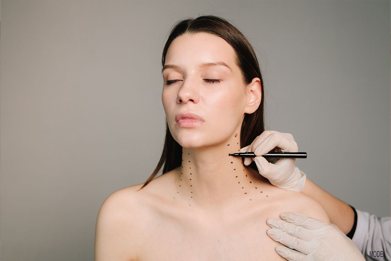 Neck Lift Treatment in Baton Rouge, LA with Botox at Z Dermatology.