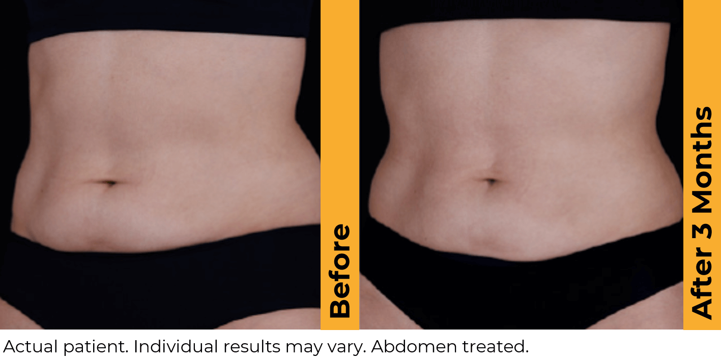 Medical Weight Loss Baton Rouge, Dr. Z