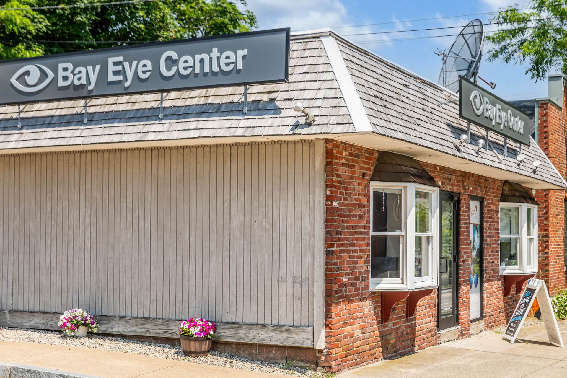 Keratoconus Lens Fitting